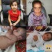 گزارش جراحی قلب 4 کودک