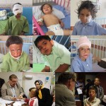 گزارش درمان کودکان سوخته