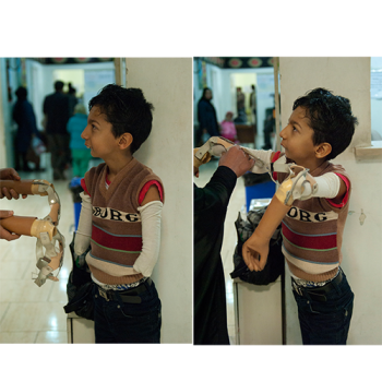 روياهاي كودكي رنگ واقعيت به خود گرفت گزارش درمان حسین